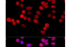 Immunofluorescence analysis of HeLa cells using CYBA Polyclonal Antibody at dilution of 1:100 (40x lens). (CYBA antibody)