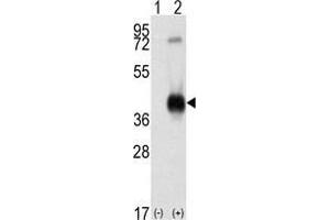 Western blot analysis of CAMK1 (arrow) using rabbit polyclonal CAMK1 Antibody (C-term) . (CAMK1 antibody  (C-Term))