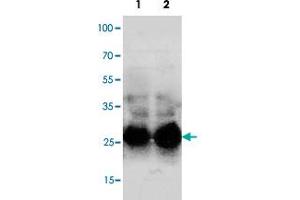 Western blot analysis of mouse lung with Sftpa1 polyclonal antibody . (Surfactant Protein A1 antibody  (C-Term))