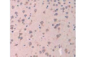 IHC-P analysis of Mouse Tissue, with DAB staining. (ESM1 antibody  (AA 22-184))