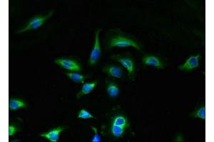 Immunofluorescent analysis of A549 cells using ABIN7166257 at dilution of 1:100 and Alexa Fluor 488-congugated AffiniPure Goat Anti-Rabbit IgG(H+L) (UNC5 (AA 15-82) antibody)