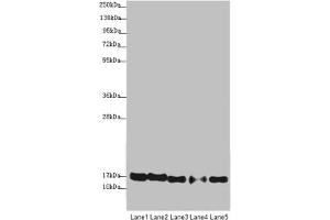 Western blot All lanes: ATP5F1D antibody at 1. (ATP5F1D antibody  (AA 1-168))