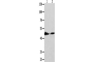 Gel: 10 % SDS-PAGE, Lysate: 40 μg, Lane 1-2: Hela cells, 293T cells, Primary antibody: ABIN7191756(P2RY11 Antibody) at dilution 1/500, Secondary antibody: Goat anti rabbit IgG at 1/8000 dilution, Exposure time: 1 minute (P2RY11 antibody)