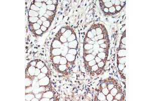 Immunohistochemistry (IHC) image for anti-Adenomatous Polyposis Coli (APC) (AA 2544-2843) antibody (ABIN1678690)