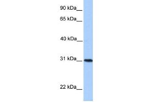 WB Suggested Anti-HELT Antibody Titration:  0. (HELT antibody  (Middle Region))