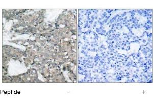Image no. 1 for anti-Mitogen-Activated Protein Kinase Kinase 1 (MAP2K1) (Ser221) antibody (ABIN197388) (MEK1 antibody  (Ser221))