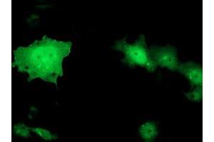 Anti-TOMM34 mouse monoclonal antibody (ABIN2454814) immunofluorescent staining of COS7 cells transiently transfected by pCMV6-ENTRY TOMM34 (RC201083). (TOMM34 antibody)
