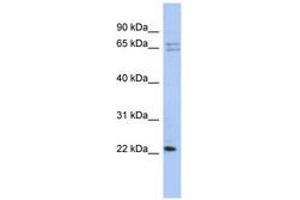 Image no. 1 for anti-Ribosomal Protein L18 (RPL18) (N-Term) antibody (ABIN6743981) (RPL18 antibody  (N-Term))