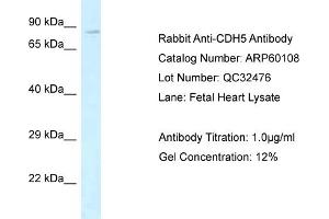 Western Blotting (WB) image for anti-Cadherin 5 (CDH5) (Middle Region) antibody (ABIN2788335) (Cadherin 5 antibody  (Middle Region))