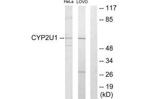 Western Blotting (WB) image for anti-Cytochrome P450, Family 2, Subfamily U, Polypeptide 1 (CYP2U1) (Internal Region) antibody (ABIN1850362) (CYP2U1 antibody  (Internal Region))