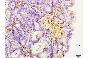 Formalin-fixed and paraffin embedded rat colitis tissue labeled with Anti-Integrin β2/CD18/LFA-1 Polyclonal Antibody, Unconjugated  at 1:200, followed by conjugation to the secondary antibody and DAB staining (Integrin beta 2 antibody  (AA 701-770))