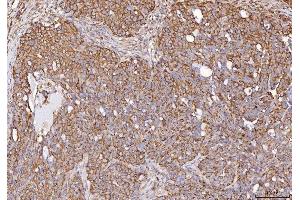 IHC analysis of Calmegin/CLGN using anti-Calmegin/CLGN antibody (ABIN7601481).