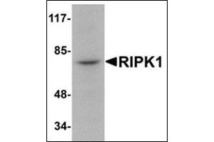 Western blot analysis of RIPK1 in rat kidney tissue lysate with this product at 1 μg/ml. (RIPK1 antibody  (N-Term))