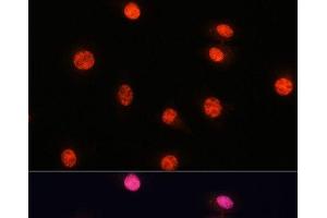 Immunofluorescence (IF) image for anti-SMAD, Mothers Against DPP Homolog 2 (SMAD2) (pSer423), (pSer425), (pSer465), (pSer467) antibody (ABIN7265256)