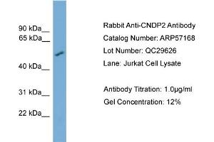 WB Suggested Anti-CNDP2  Antibody Titration: 0. (CNDP2 antibody  (Middle Region))