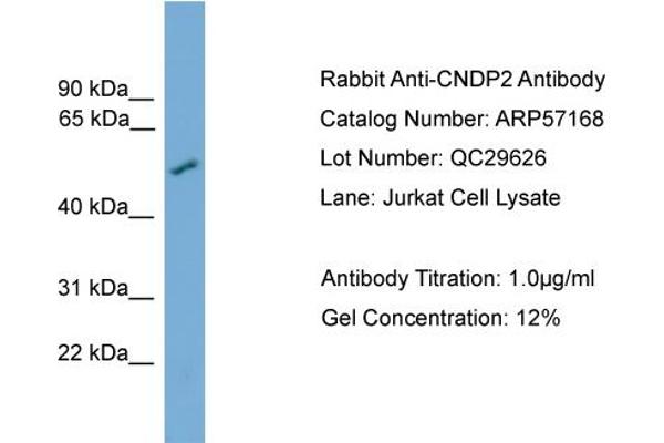 CNDP2 anticorps  (Middle Region)