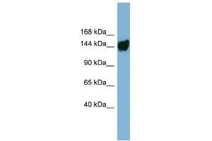 Human ACHN; WB Suggested Anti-AASDH Antibody Titration: 0. (AASDH antibody  (Middle Region))