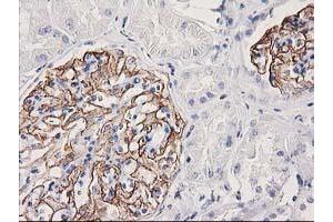 Immunohistochemical staining of paraffin-embedded Human Kidney tissue using anti-PDLIM2 mouse monoclonal antibody. (PDLIM2 antibody)