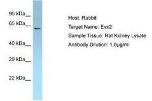 Image no. 1 for anti-Homeobox even-skipped homolog protein 2 (EVX2) (AA 51-100) antibody (ABIN6749824) (EVX2 antibody  (AA 51-100))