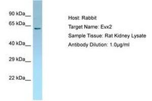 Image no. 1 for anti-Homeobox even-skipped homolog protein 2 (EVX2) (AA 51-100) antibody (ABIN6749824)