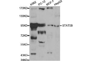 Western blot analysis of extracts of various cell lines, using STAT5B antibody. (STAT5B antibody)
