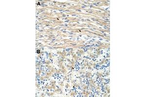 Immunohistochemical staining (Formalin-fixed paraffin-embedded sections) of human muscle (A) and human liver (B) with EXOSC6 polyclonal antibody  at 4-8 ug/mL working concentration.