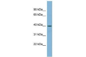 Western Blot showing ETV3L antibody used at a concentration of 1-2 ug/ml to detect its target protein. (ETV3L antibody  (Middle Region))