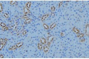 ABIN6279098 at 1/100 staining Mouse kidney tissue by IHC-P. (AGXT2 antibody  (Internal Region))