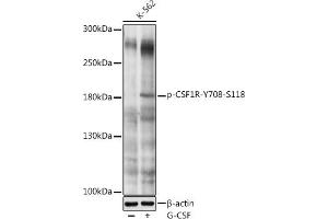 Western blot analysis of extracts of K-562 cells, using Phospho-CSF1R-Y708 antibody (ABIN6135205, ABIN6136052, ABIN6136053 and ABIN6225625) at 1:1000 dilution. (CSF1R antibody  (pTyr708))