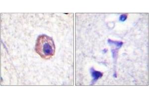 Immunohistochemistry analysis of paraffin-embedded human brain tissue, using MRLC2 (Ab-18) Antibody. (MYL12B antibody  (AA 3-52))