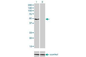 Western blot analysis of C9orf98 over-expressed 293 cell line, cotransfected with C9orf98 Validated Chimera RNAi (Lane 2) or non-transfected control (Lane 1). (AK8 antibody  (AA 381-479))