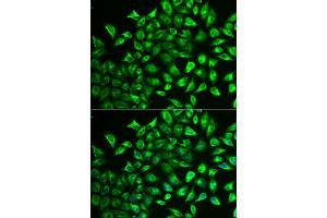 Immunofluorescence analysis of U2OS cells using MMRN1 antibody (ABIN6129053, ABIN6143926, ABIN6143927 and ABIN6222357). (Multimerin 1 antibody  (AA 949-1228))