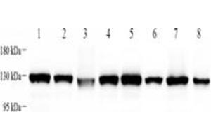 Western blot analysis of KIF5B (ABIN7074440),at dilution of 1: 4000,Lane 1: Mouse heart tissue lysate,Lane 2: Mouse brain tissue lysate,Lane 3: Mouse uterus tissue lysate,Lane 4: Mouse skin tissue lysate,Lane 5: Rat heart tissue lysate,Lane 6: Rat brain tissue lysate,Lane 7: Rat uterus tissue lysate,Lane 8: Rat skin tissue lysate (KIF5B antibody)