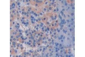 Figure. (IL17B antibody  (AA 21-180))