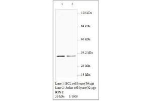 Image no. 1 for anti-Ribosomal Protein S2 (RPS2) antibody (ABIN791359) (RPS2 antibody)