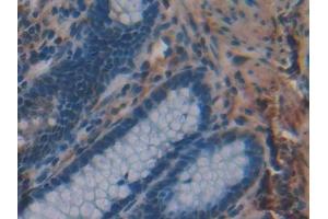 Detection of MPG in Human Rectum Tissue using Polyclonal Antibody to N-Methylpurine DNA Glycosylase (MPG) (MPG antibody  (AA 221-296))