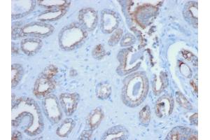 Formalin-fixed, paraffin-embedded human Prostate stained with Pan-Cytokeratin Mouse Monoclonal Antibody (PCK/3150). (KRT antibody)