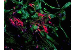 Immunostaining of mixed neuron/glial cultures showing specific cytoplasmic labeling of dendrites and perikarya of neuronal cells in red with anti-MAP2C/D and astrocyte and fibroblast labeling (green) with anti-vimentin ( ABIN361371). (MAP2 antibody)