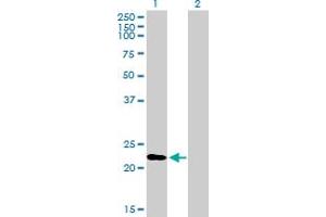 Western Blot analysis of RGS1 expression in transfected 293T cell line by RGS1 MaxPab polyclonal antibody. (RGS1 antibody  (AA 1-196))