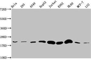 Western Blot Positive WB detected in: Hela whole cell lysate, 293 whole cell lysate, A549 whole cell lysate, HepG2 whole cell lysate, Jurkat whole cell lysate, K562 whole cell lysate, HL60 whole cell lysate, MCF-7 whole cell lysate, LO2 whole cell lysate All lanes: HIST1H1E antibody at 1:500 Secondary Goat polyclonal to rabbit IgG at 1/40000 dilution Predicted band size: 22 kDa Observed band size: 22 kDa (HIST1H1E antibody)
