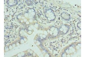 Immunohistochemistry of paraffin-embedded human small intestine tissue using ABIN7176016 at dilution of 1:100 (Zinc Finger and SCAN Domain Containing 9 (ZSCAN9) (AA 1-394) antibody)