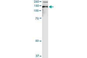 Immunoprecipitation of TIMELESS transfected lysate using anti-TIMELESS MaxPab rabbit polyclonal antibody and Protein A Magnetic Bead , and immunoblotted with TIMELESS purified MaxPab mouse polyclonal antibody (B01P) . (TIMELESS antibody  (AA 1-1208))