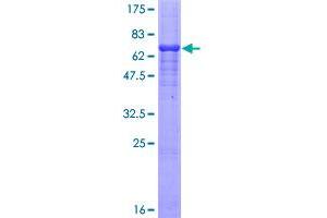 Image no. 1 for Myostatin (MSTN) (AA 1-375) protein (GST tag) (ABIN1311485)