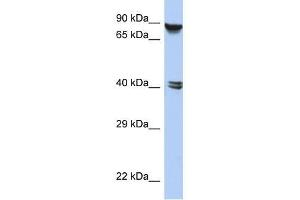 Western Blot showing ZNF429 antibody used at a concentration of 1-2 ug/ml to detect its target protein. (ZNF429 antibody  (N-Term))