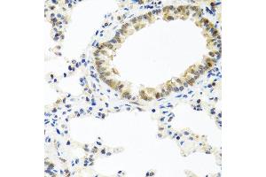 Immunohistochemistry of paraffin-embedded rat lung using BMP5 antibody at dilution of 1:100 (40x lens). (BMP5 antibody)