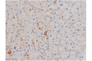 ABIN6256119 and ABIN6267471 at 1/200 staining Rat liver tissue sections by IHC-P.