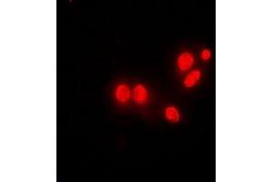 Immunofluorescent analysis of DNAJB6 staining in MCF7 cells. (DNAJB6 antibody)