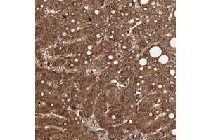 Immunohistochemical staining of human liver with TROVE2 polyclonal antibody  shows strong cytoplasmic positivity in hepatocytes. (TROVE2 antibody)