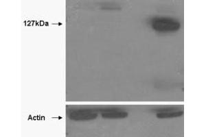 Image no. 1 for anti-Tankyrase, TRF1-Interacting Ankyrin-Related ADP-Ribose Polymerase 2 (TNKS2) (AA 800-900) antibody (ABIN401534) (TNKS2 antibody  (AA 800-900))