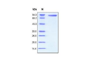 Human CD4, Fc Tag on SDS-PAGE under reducing (R) condition. (CD4 Protein (CD4) (AA 26-396) (Fc Tag))